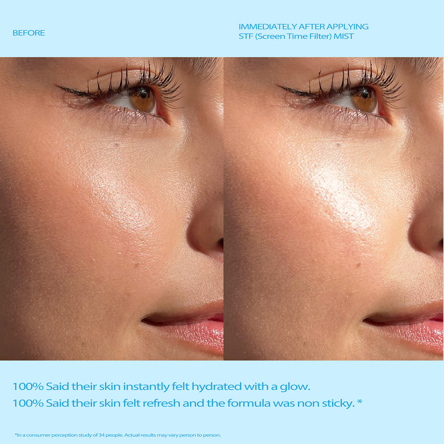 STF (screen time filter) Mist - A blue light blocking, anti-aging face mist.